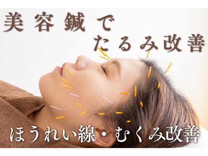 アボット(ABBOTT)の写真