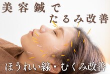 アボット(ABBOTT)