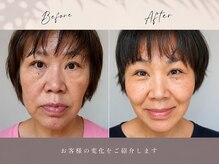 アイリー(IRIE)の雰囲気(小顔、たるみ管理はアイリーへお任せ下さい。)