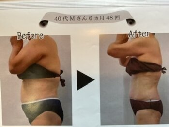 美活くらぶ/全身サイズダウン