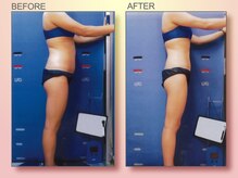 ジュリア オージェ 四条河原町店/ビフォーアフター（脂肪燃焼）