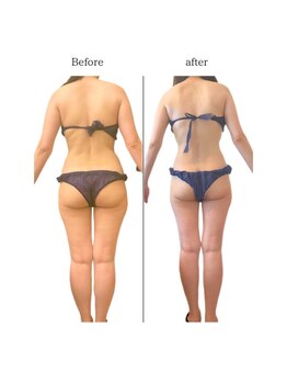 マリーメリー(marie merry)/痩身