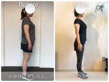 痩せるだけでなく巻き肩,姿勢,肩こり,むくみも一緒に改善◎