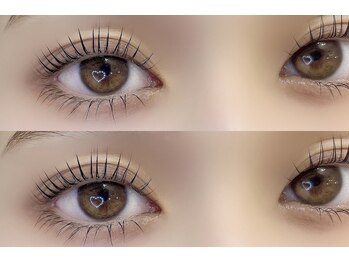 リングス(Riings)