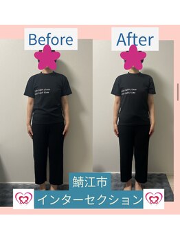 腰の整体インターセクション/美容整体