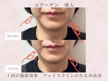 エステサロン プラスエー(+A)