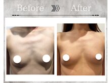 フェリス(Feliz)/【バストアップ/育乳/安城】