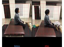 ストレチックス 近江八幡店/首・肩・腰に痛みがあった男性