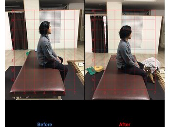 ストレチックス 近江八幡店/首・肩・腰に痛みがあった男性