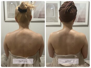 リバース(Rebirth)/カチカチをふわふわゆるゆるへ