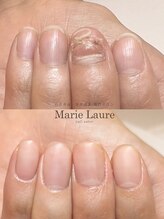 マリーロール 梅田店(Marie Laure)/自爪育成/深爪矯正/ネイルケア