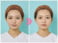 スピード小顔 渋谷店 (Speed)/体験ビフォーアフター