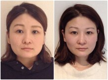 ウェリナ平和堂長久手院/小顔矯正/骨盤矯正/痩身/整体