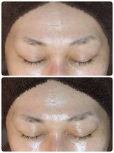 ウララ(ulala)/ララピール1回目