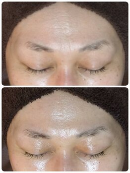 ウララ(ulala)/ララピール1回目