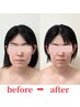 【時短!メイクしたまま◎】小顔骨格調整 堂々とマスクを外せるV小顔へ!  60分
