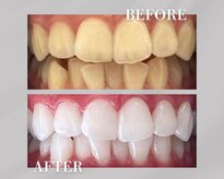 ホワイトニングショップ 銀座7丁目店(WHITENING SHOP)