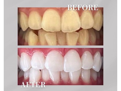 ホワイトニングショップ 銀座7丁目店(WHITENING SHOP)の写真