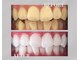 ホワイトニングショップ 銀座7丁目店(WHITENING SHOP)の写真