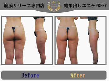 プレリー 自由が丘店/全身筋膜リリースで美脚