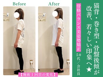 木温ノ輪/お客様の変化/骨格美容矯正