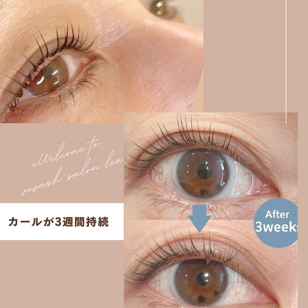 レア(lea)｜ホットペッパービューティー