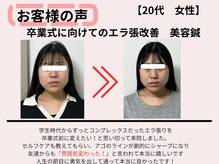 サロンスマイル/20代美容鍼ビフォーアフター