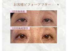 プランドール/印象を決める目がパッチリに