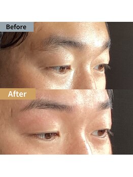 眉毛ハウス 吉祥寺店(眉毛HOUSE)/お客様の施術例(吉祥寺/東京)