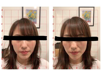 田端整体院/小顔で輪郭がスッキリ。