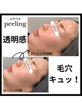 ダツモウ ミジュ(Datsumo MIJU)/ホワイトピーリング