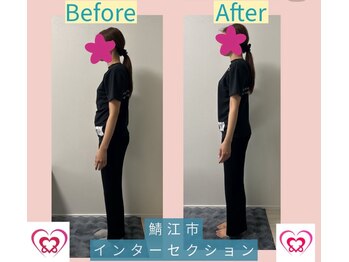 腰の整体インターセクション/姿勢改善