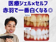 スマイルホワイト 赤羽店