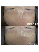 リノア(Linoa)/REVIVE ナチュラルハーブ