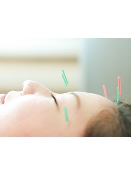 鍼灸施術を受けたい