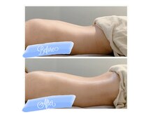 ジュ ベル(je.belle)の雰囲気（【驚きの変化】最新マシン×リンパで、理想のボディラインへ）