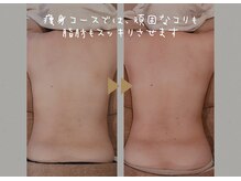 スーズ(Soothe)の雰囲気(4種のマシンがガチガチなコリや脂肪を柔らかくスッキリします♪)
