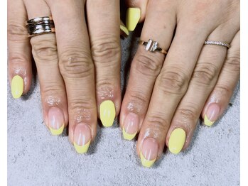 イエローフレンチ