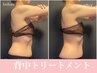 【温熱脂肪撃退マシン×ハンド】痩身背中デトックストリートメント