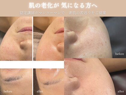 エメ(eme)の写真