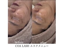 コアラッシュ 福井フェニックス通り店(COA LASH)/お悩みに合わせてご案内♪