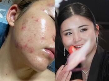 サロン リティナ(Salon Ritina)/お肌は必ず生まれ変わる