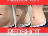 脂肪分解☆RED　SHOT　超強力☆BODYメンテしましょ☆