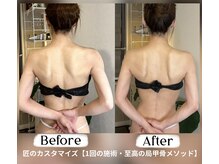 蒼(so)/骨格の歪み＝ゴツ見えの原因