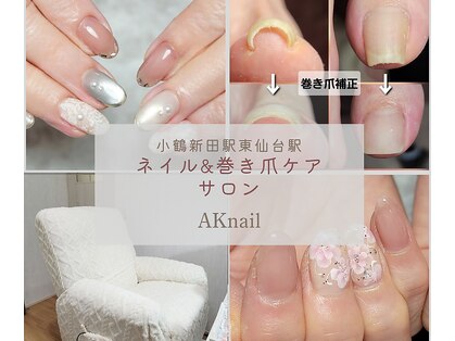 エーケーネイル(AKnail)の写真