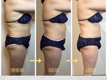 ボディケアアップ(BODY CARE UP↑)の雰囲気(内側から整えるWINBACK☆回数を重ねるごとに変化を実感。)