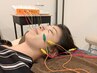【お肌ハリつやアップ♪】電気美容鍼 通常8,800円→4,980円 潤うお肌へ