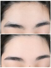 ヌケッタ 池袋/美容電気脱毛でナチュラル眉毛