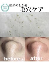 ビューティーネイル(Beauty Nail)/毛穴エクストラクション