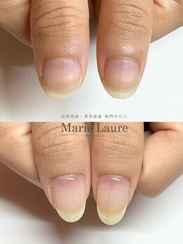 マリーロール 梅田店(Marie Laure)/自爪育成/深爪矯正/ネイルケア